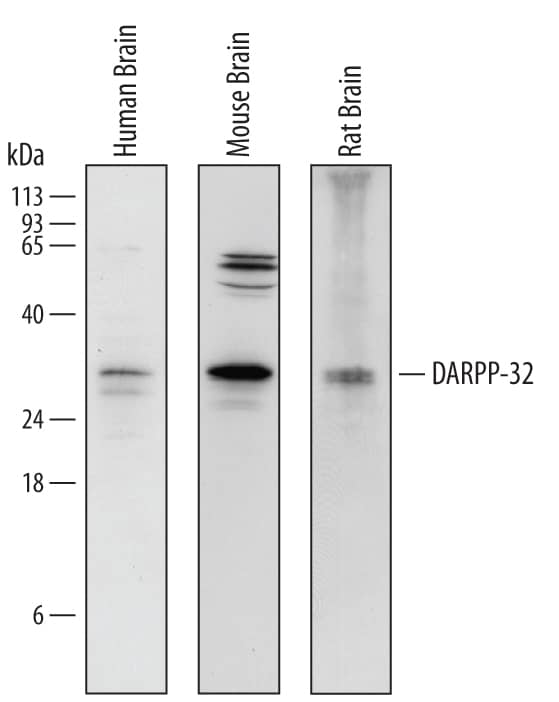 Detection of Human, Mouse, and Rat DARPP-32 antibody by Western Blot.