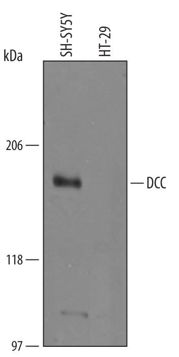 Detection of Human DCC antibody by Western Blot.