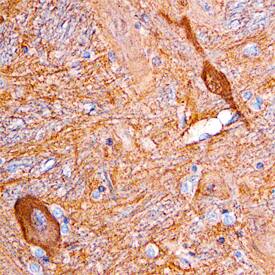 Dimethylarginine Dimethylaminohydrolase 1/DDAH1 antibody in Human Brain by Immunohistochemistry (IHC-P).