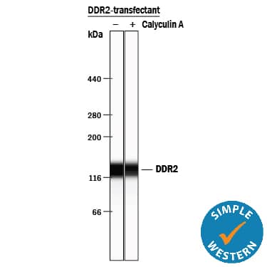 Detection of Human DDR2 antibody by Simple WesternTM.