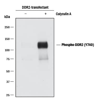 Detection of Human Phospho-DDR2 (Y740) antibody by Western Blot.