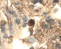 DDR2 antibody in Human Lung by Immunohistochemistry (IHC-P).