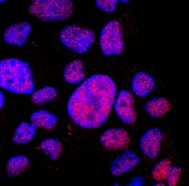 DDX17 antibody in A431 Human Cell Line by Immunocytochemistry (ICC).