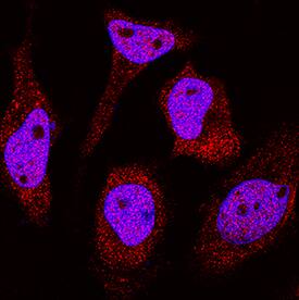 DDX1 antibody in HeLa Human Cell Line by Immunocytochemistry (ICC).