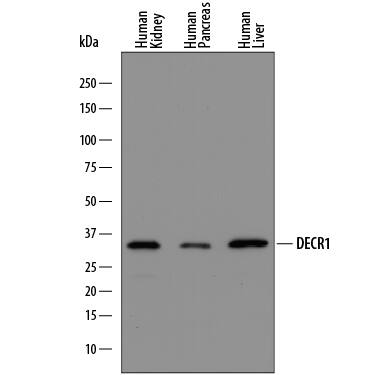 Detection of Human DECR1 antibody by Western Blot.