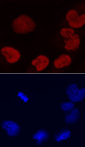 DEK antibody in HeLa Human Cell Line by Immunocytochemistry (ICC).