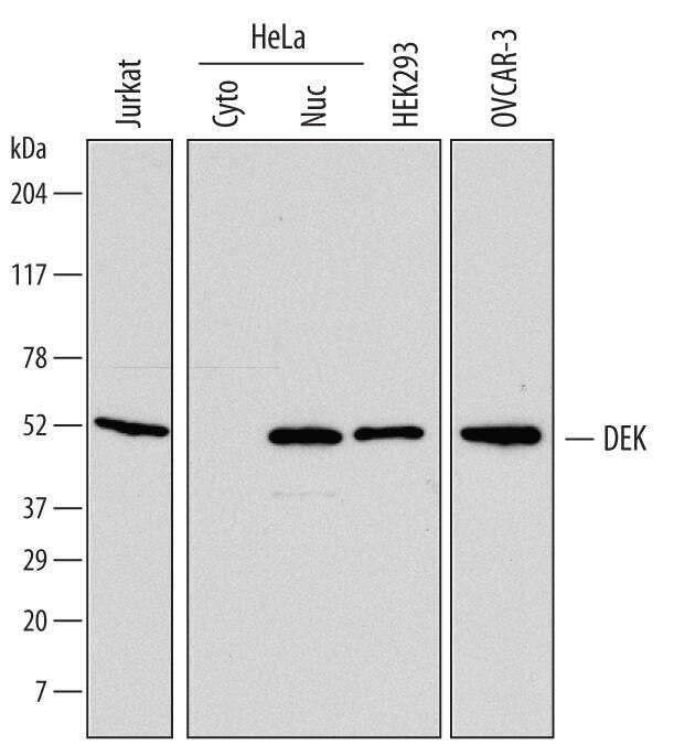 Detection of Human DEK antibody by Western Blot.