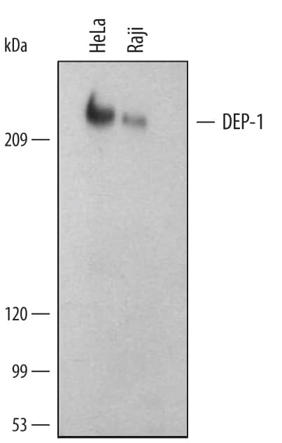 Detection of Human DEP-1/CD148 antibody by Western Blot.