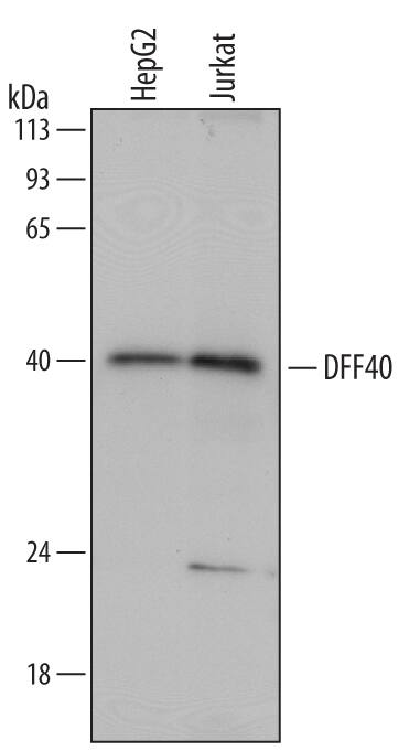 Detection of Human DFF40/CAD antibody by Western Blot.