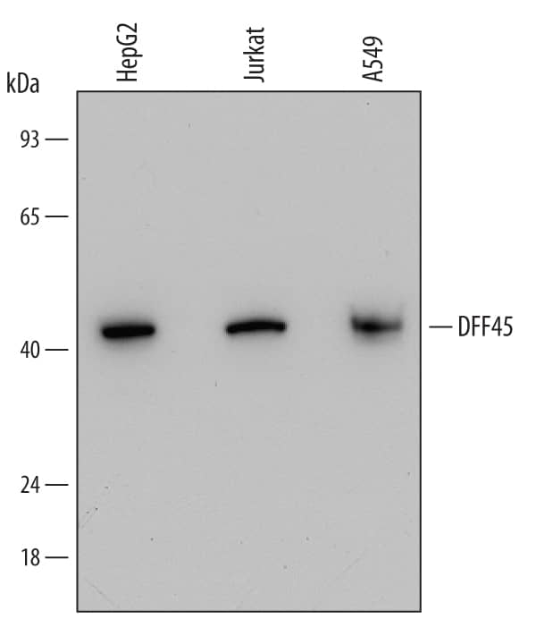 Detection of Human DFF45/ICAD antibody by Western Blot.