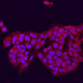 DGAT2 antibody in HepG2 Human Cell Line by Immunocytochemistry (ICC).