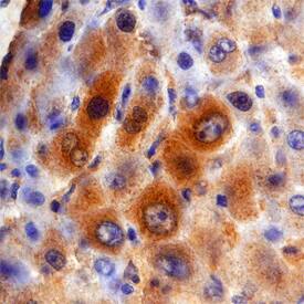 DGAT2 antibody in Human Liver by Immunohistochemistry (IHC-P).