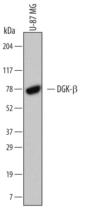 Detection of Human DGK-beta  antibody by Western Blot.