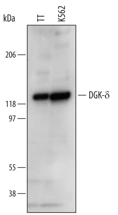 Detection of Human DGK-d antibody by Western Blot.