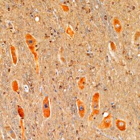 DGK-e antibody in Human Brainstem by Immunohistochemistry (IHC-P).