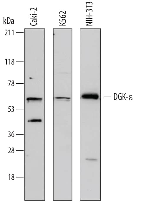 Detection of Human and Mouse DGK-e antibody by Western Blot.