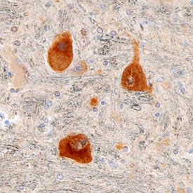 DGK-e antibody in Human Brain by Immunohistochemistry (IHC-P).