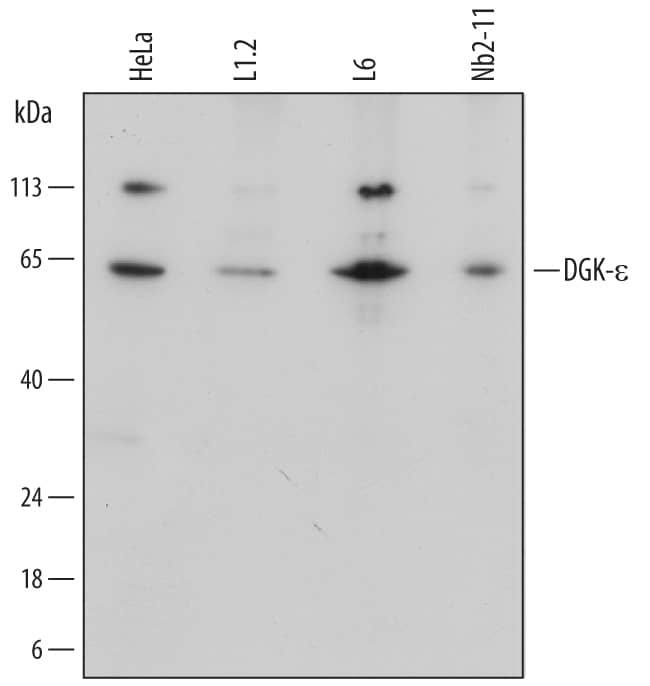 Detection of Human, Mouse, and Rat DGK-e antibody by Western Blot.