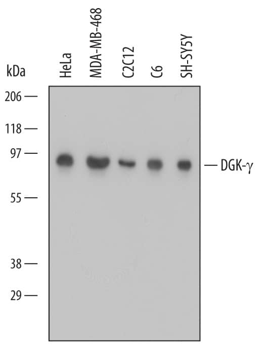 Detection of Human, Mouse, and Rat DGK-? antibody by Western Blot.