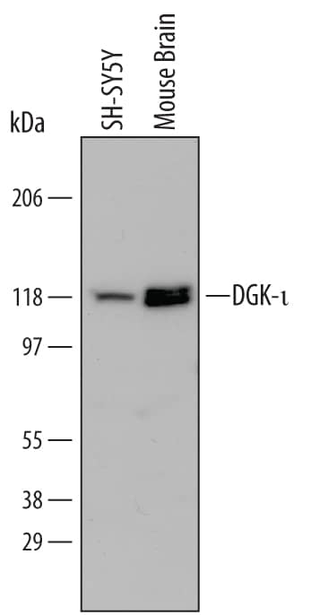 Detection of Human and Mouse DGK-? antibody by Western Blot.