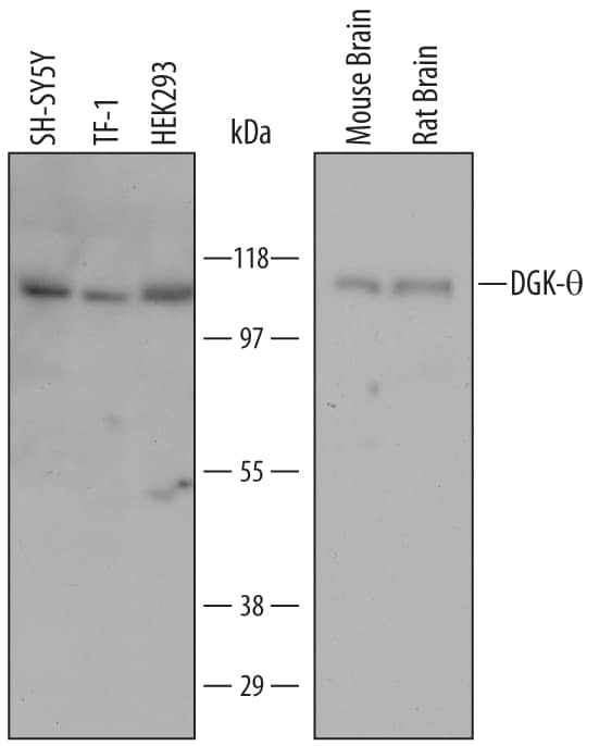 Detection of Human, Mouse, and Rat DGK-? antibody by Western Blot.