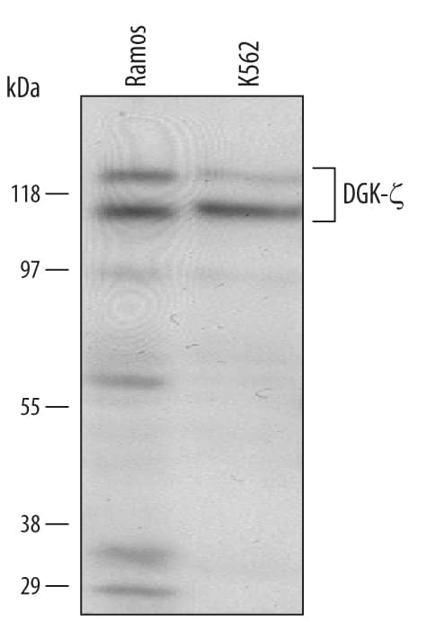 Detection of Human DGK-? antibody by Western Blot.