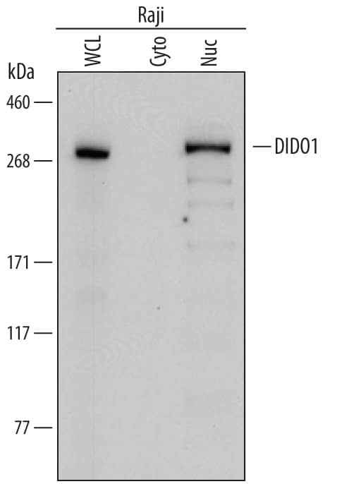 Detection of Human DIDO1 antibody by Western Blot.