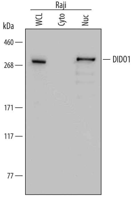 Detection of Human DIDO1 antibody by Western Blot.