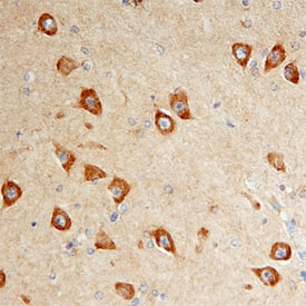 DISC1 antibody in Human Brain by Immunohistochemistry (IHC-P).