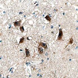 DISC1 antibody in Human Brain by Immunohistochemistry (IHC-P).
