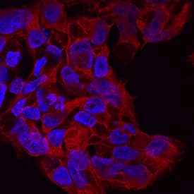 DISP1 antibody in BG01V Human Embryonic Stem Cells by Immunocytochemistry (ICC).