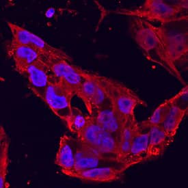 DISP1 antibody in BG01V Human Embryonic Stem Cells by Immunocytochemistry (ICC).