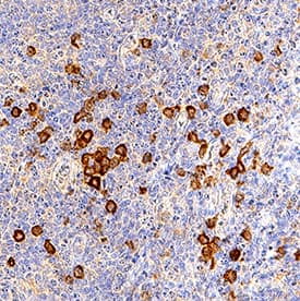 DLEC/CLEC4C/BDCA-2 antibody in Human Tonsil by Immunohistochemistry (IHC-P).