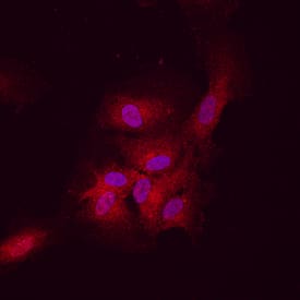DLL4 antibody in HUVEC Human Cells by Immunocytochemistry (ICC).
