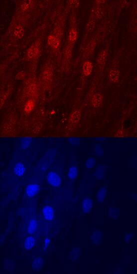 DLX5 antibody in Human Mesenchymal Stem Cells by Immunocytochemistry (ICC).