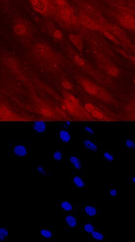 DLX5 antibody in Human Mesenchymal Stem Cells by Immunocytochemistry (ICC).