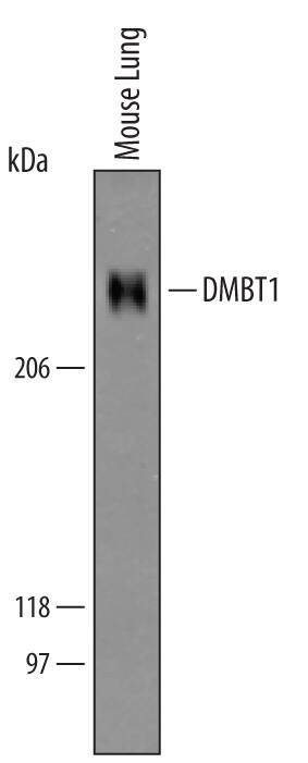 Detection of Mouse DMBT1 antibody by Western Blot.