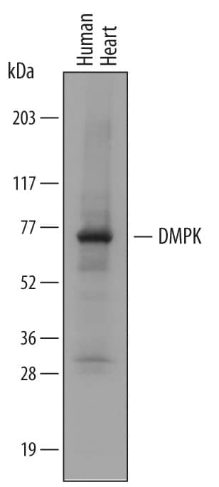 Detection of Human DMPK antibody by Western Blot.