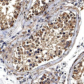 DNAH17 antibody in Human Testis by Immunohistochemistry (IHC-P).