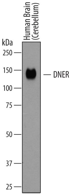 Detection of Human DNER antibody by Western Blot.