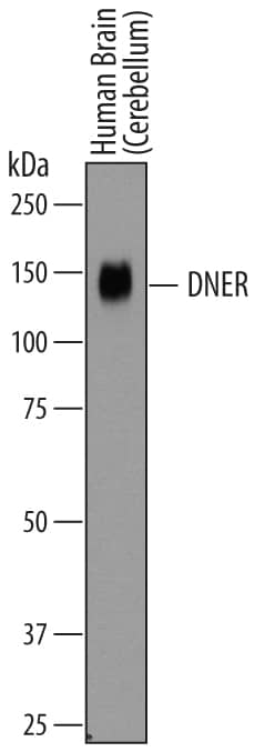 Detection of Human DNER antibody by Western Blot.