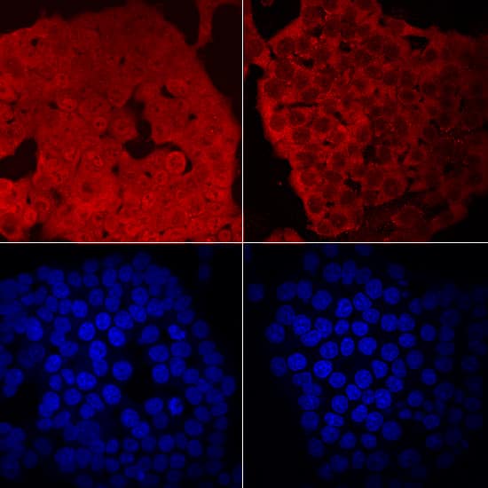 DNMT1 antibody in HCT-116 Human Cell Line by Immunocytochemistry (ICC).