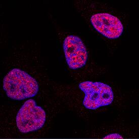 DNMT1 antibody in HeLa Human Cell Line by Immunocytochemistry (ICC).
