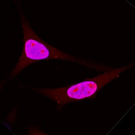 DNMT3A antibody in HeLa Human Cell Line by Immunocytochemistry (ICC).