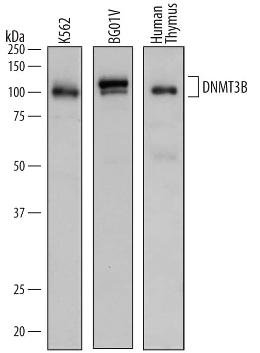 Detection of Human DNMT3B antibody by Western Blot.