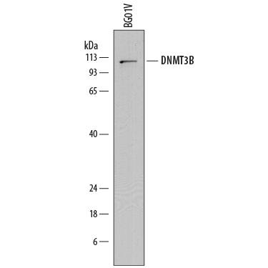 Detection of Human DNMT3B antibody by Western Blot.