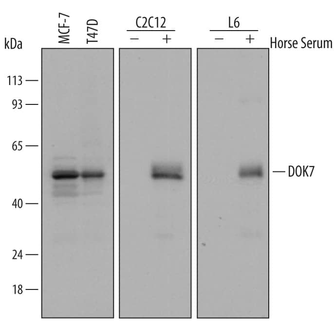 Detection of Human, Mouse, and Rat DOK7 antibody by Western Blot.