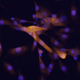 DOK7 antibody in C2C12 Mouse Cell Line by Immunocytochemistry (ICC).