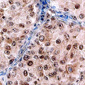 DOT1L antibody in Human Lung by Immunohistochemistry (IHC-P).