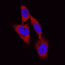 DPP3 antibody in HeLa Human Cell Line by Immunocytochemistry (ICC).